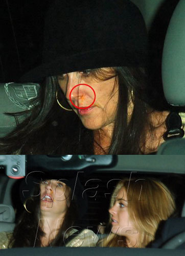 What is up with Demi's nose? Even Lindsay is scared and feeling busted.